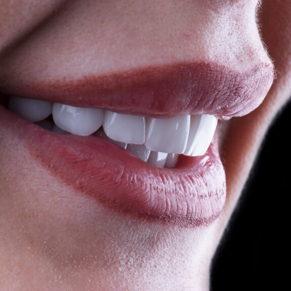 Closeup of flawless smile after cosmetic dental bonding