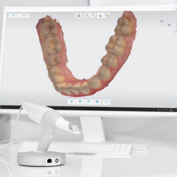 Digital impressions in E 4 D same day dental restoration system