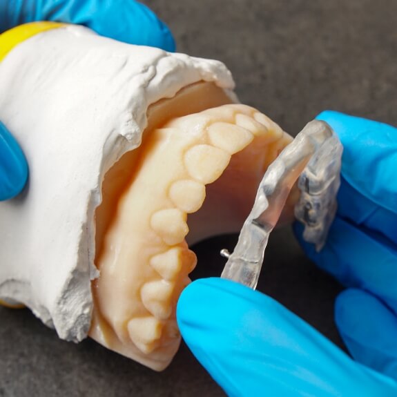 Dentist fitting custom occlusal splint to smile model