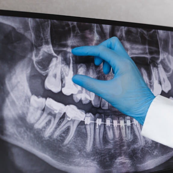 Dentist looking at all digital x-rays