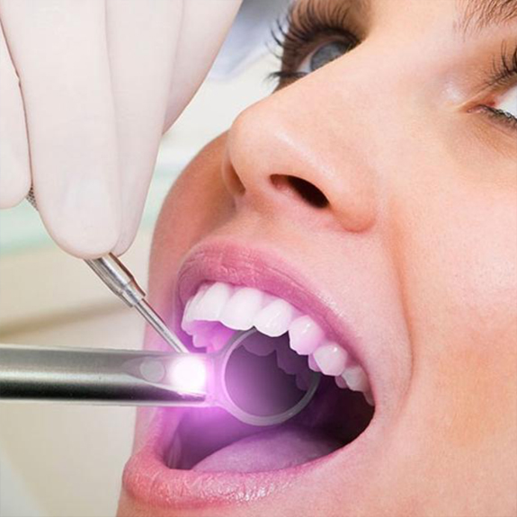 Dentist using oral I D oral cancer screening tool