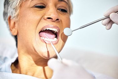 a patient getting her teeth checked by her dentist