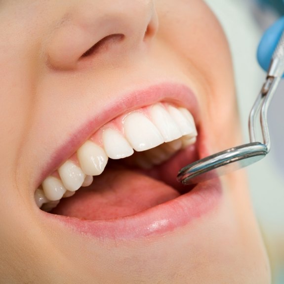 Dentist examining tooth length