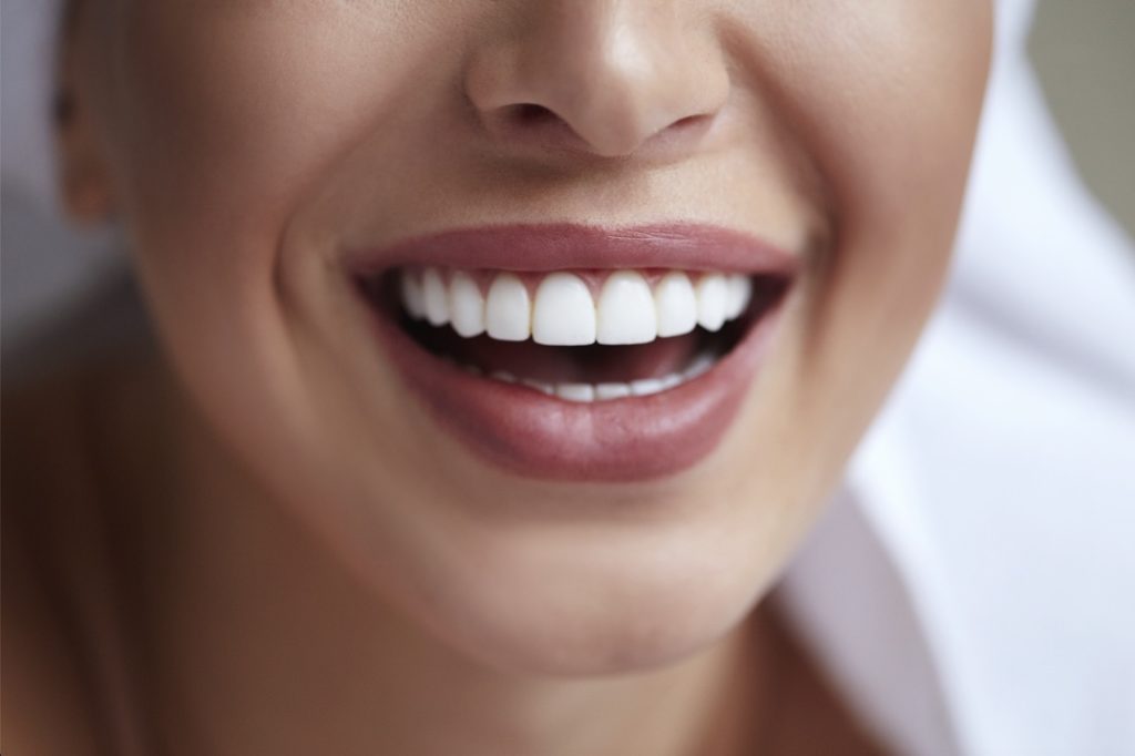 Woman after teeth whitening treatment at dentist in Dublin