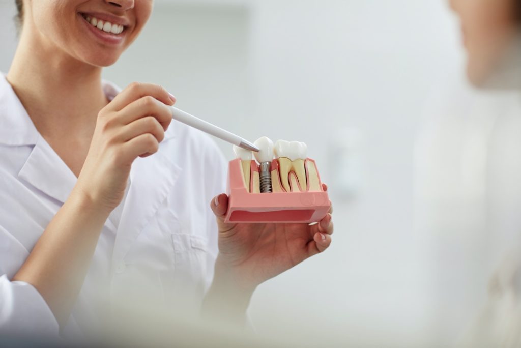 Dentist holding model of dental implant in Dublin