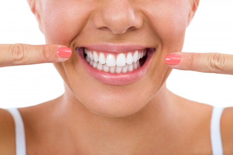 Woman smiling and pointing to her teeth